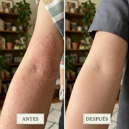 Hair Removal Smoothing Solution