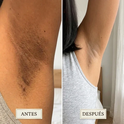Hair Removal Smoothing Solution