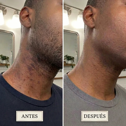Hair Removal Smoothing Solution